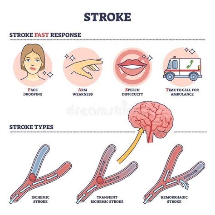 The Pioneer Woman: Recognizing And Responding To Strokes