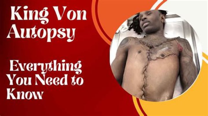 Ultimate Guide: Von King Autopsy Findings And Report